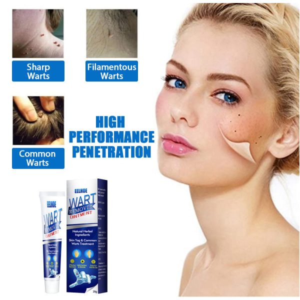 Wart Remover Cream Fast & Effective Wart Remover Cream Fast & Effective