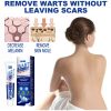 Wart Remover Cream Fast & Effective Wart Remover Cream Fast & Effective
