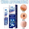 Wart Remover Cream Fast & Effective Wart Remover Cream Fast & Effective