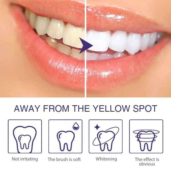 Whitening Dental Gel Pen Whitening Dental Gel Pen