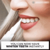 Whitening Dental Gel Pen Whitening Dental Gel Pen