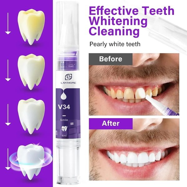 Whitening Dental Gel Pen Whitening Dental Gel Pen