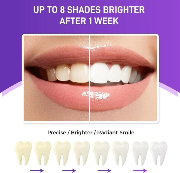 Whitening Dental Gel Pen Whitening Dental Gel Pen